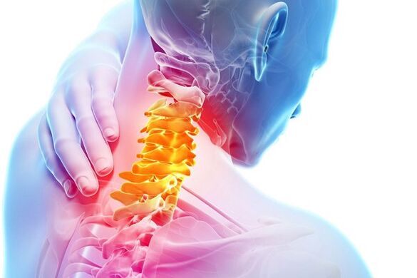 D'Ursaachen vun der Gebärmutterhals Osteochondrosis