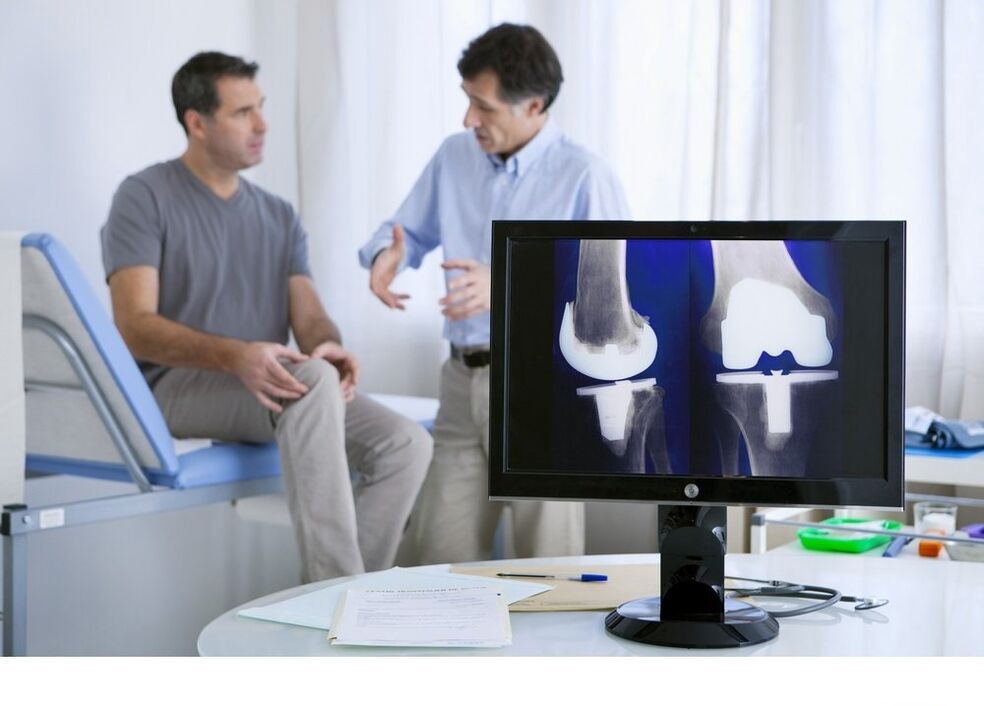 Arthrosis vum Knéi Gelenk an der X -AY Bild